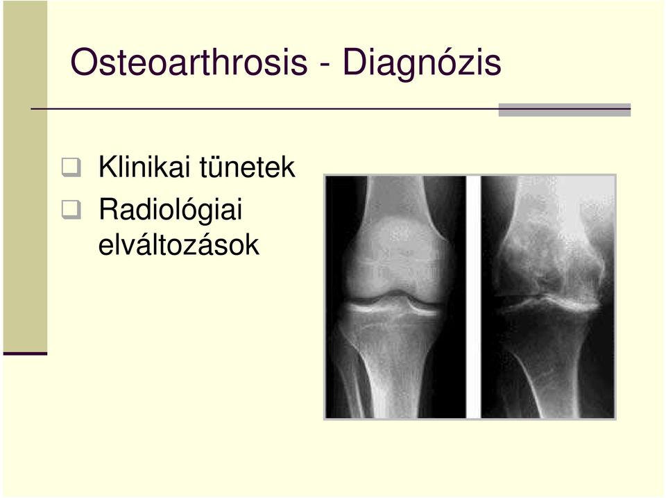 Klinikai tünetek