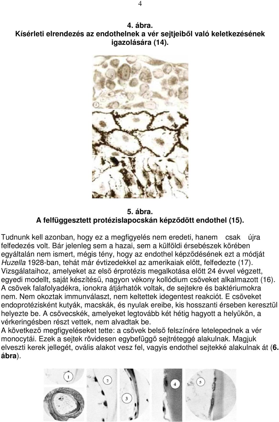 Bár jelenleg sem a hazai, sem a külföldi érsebészek körében egyáltalán nem ismert, mégis tény, hogy az endothel képzıdésének ezt a módját Huzella 1928-ban, tehát már évtizedekkel az amerikaiak elıtt,