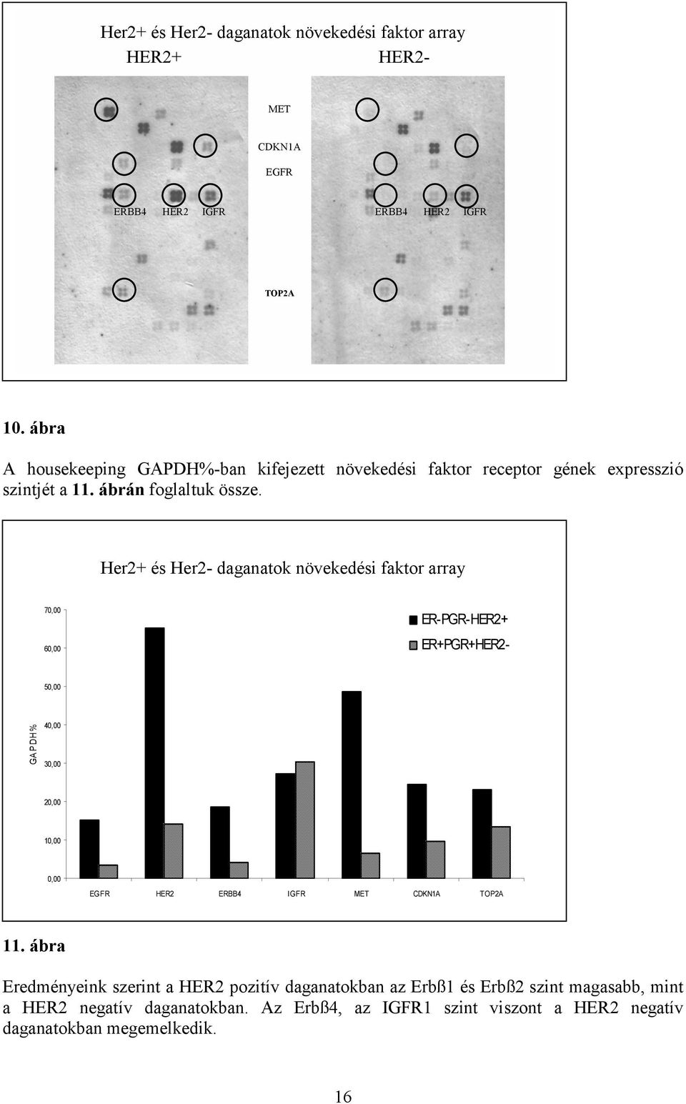 Her2+ és Her2- daganatok növekedési faktor array 70,00 60,00 ER-PGR-HER2+ Her2+ és Her2- daganatok növekedési faktor array HER2+ HER2- ER+PGR+HER2-50,00