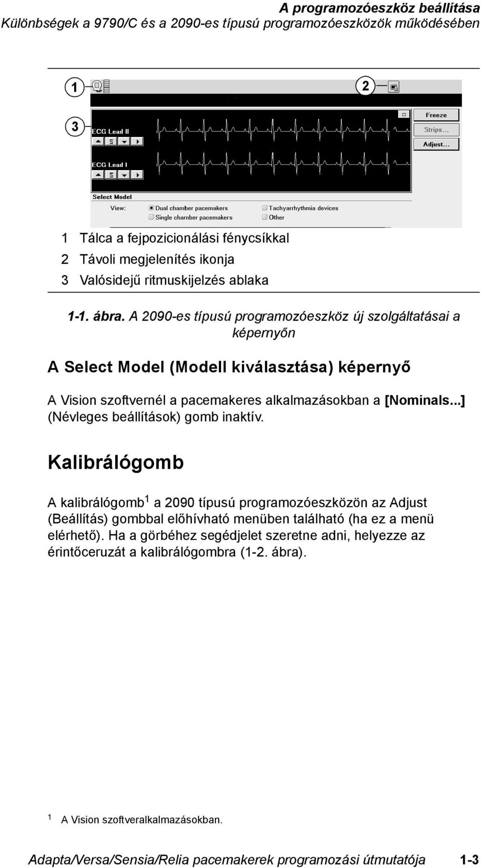 A 2090-es típusú programozóeszköz új szolgáltatásai a képernyőn A Select Model (Modell kiválasztása) képernyő A Vision szoftvernél a pacemakeres alkalmazásokban a [Nominals.