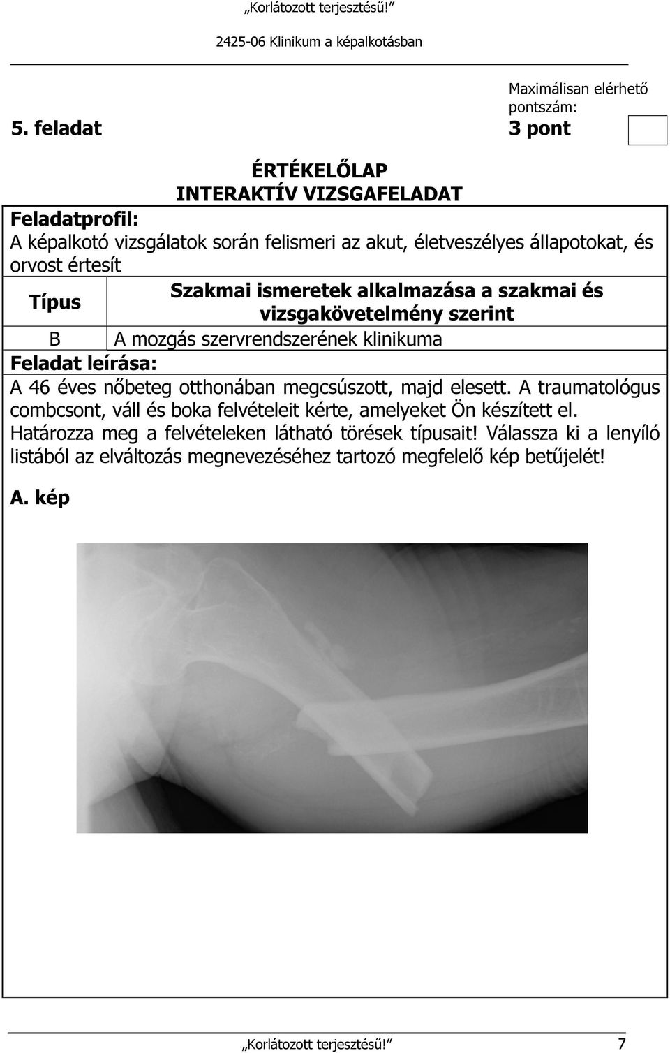 szervrendszerének klinikuma A 46 éves nőbeteg otthonában megcsúszott, majd elesett.