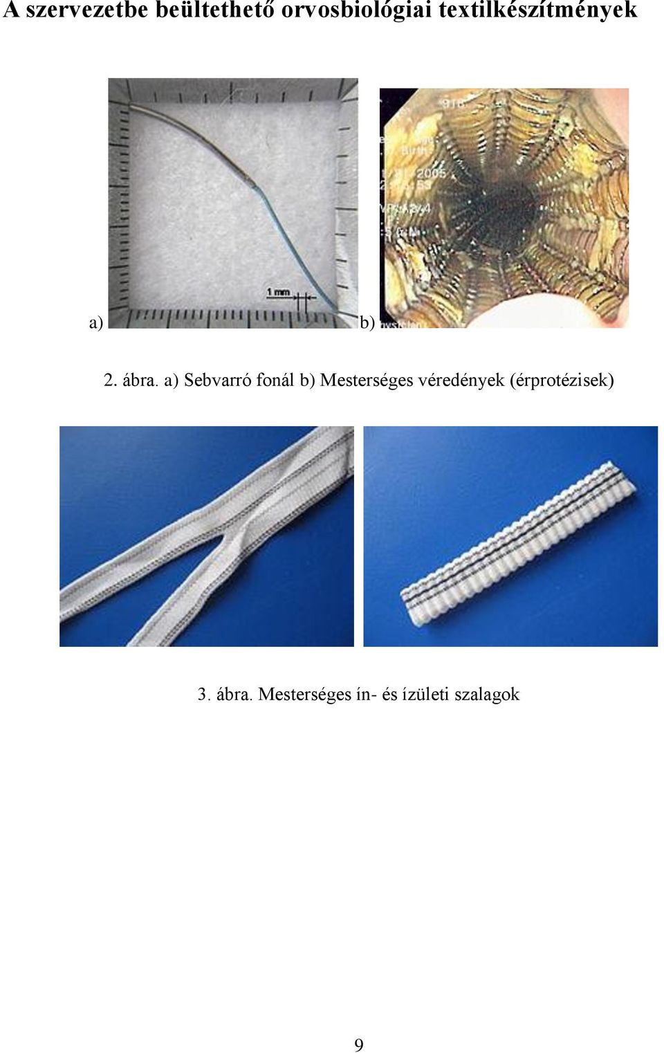 a) Sebvarró fonál b) Mesterséges véredények