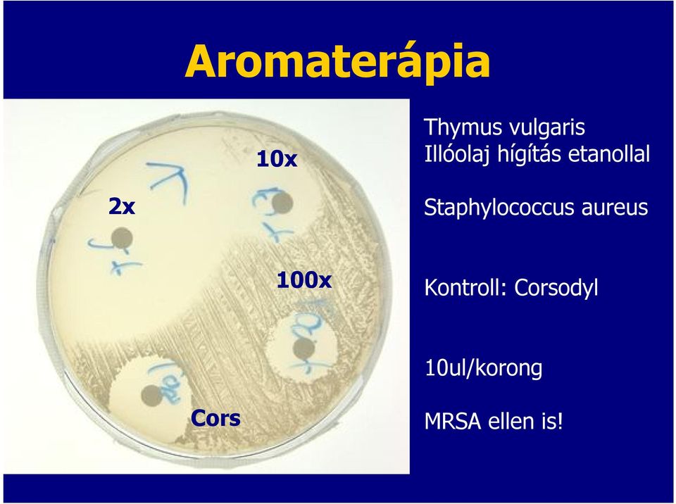 Staphylococcus aureus 100x