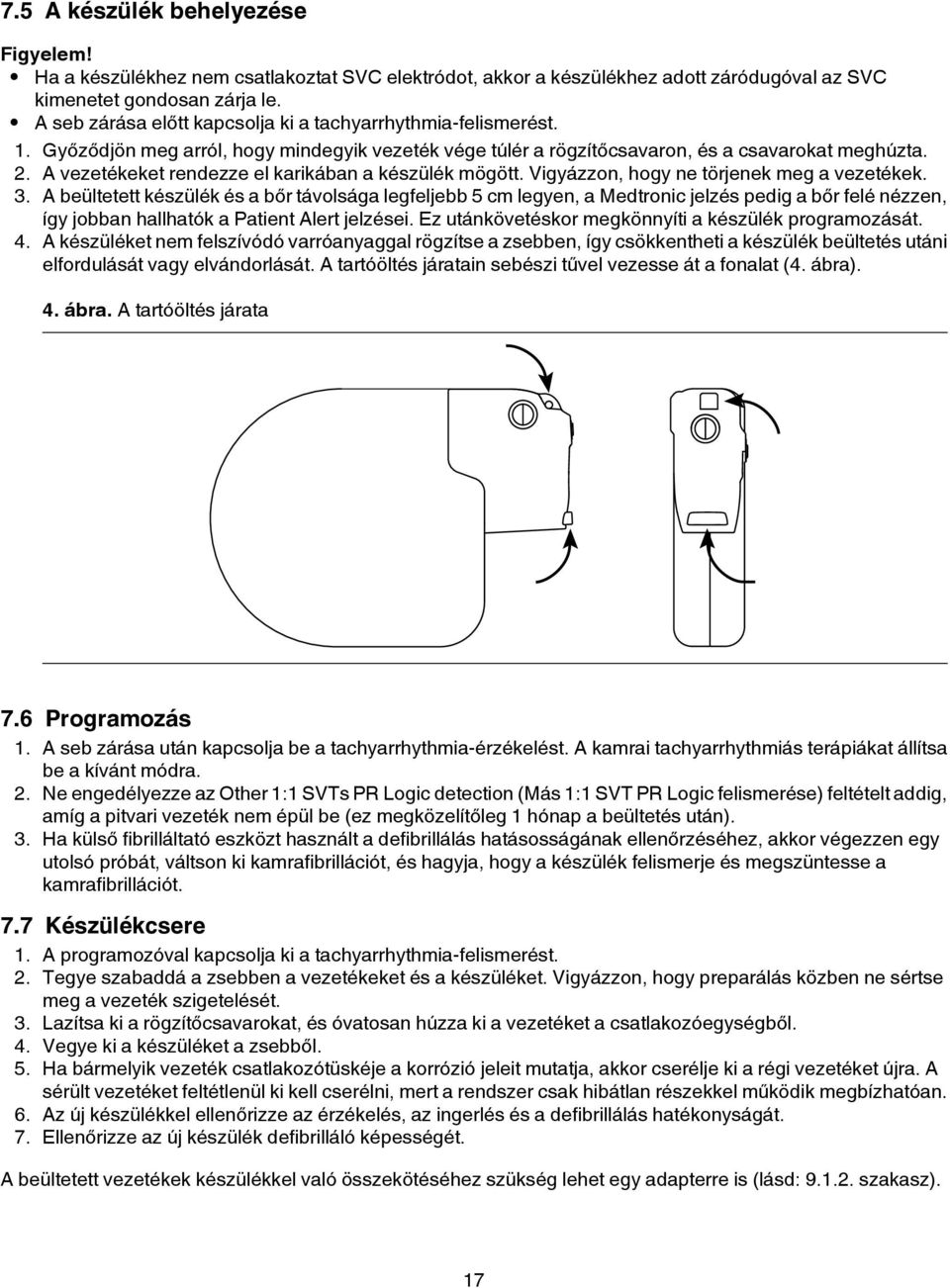 A vezetékeket rendezze el karikában a készülék mögött. Vigyázzon, hogy ne törjenek meg a vezetékek. 3.