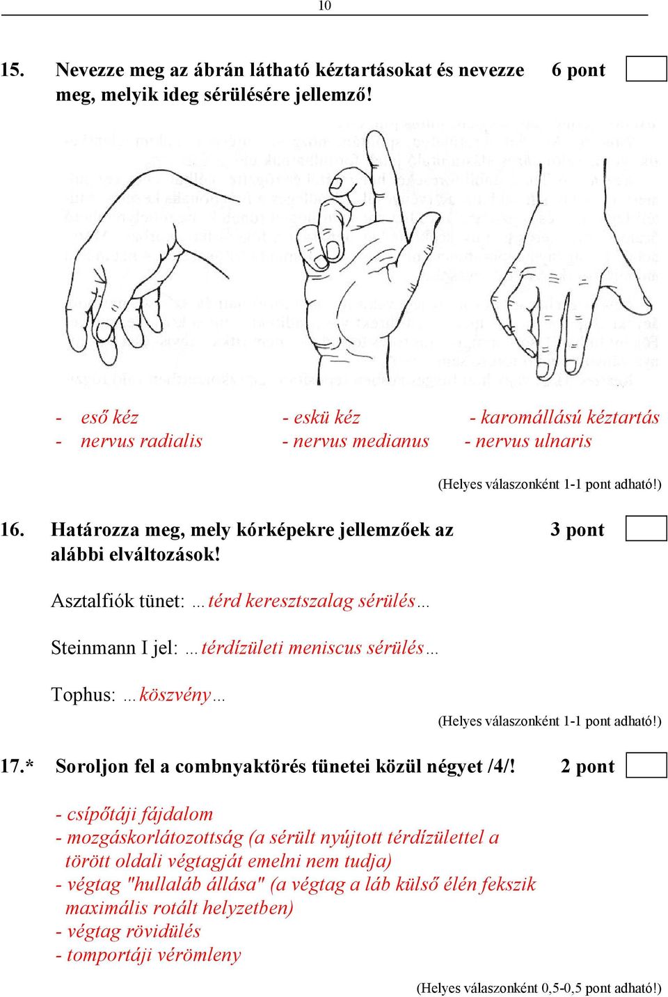 Asztalfiók tünet: térd keresztszalag sérülés Steinmann I jel: térdízületi meniscus sérülés Tophus: köszvény 17.* Soroljon fel a combnyaktörés tünetei közül négyet /4/!