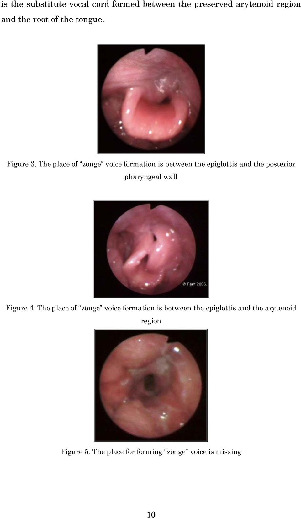 The place of zönge voice formation is between the epiglottis and the posterior pharyngeal