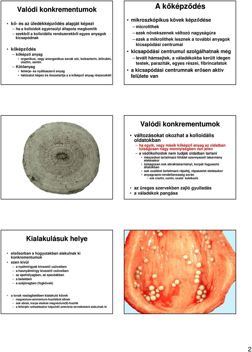 mikroszkópikus kövek képzıdése microlithek ezek növekszenek változó nagyságúra ezek a mikrolithek lesznek a további anyagok kicsapódási centrumai kicsapódási centrumul szolgálhatnak még levált