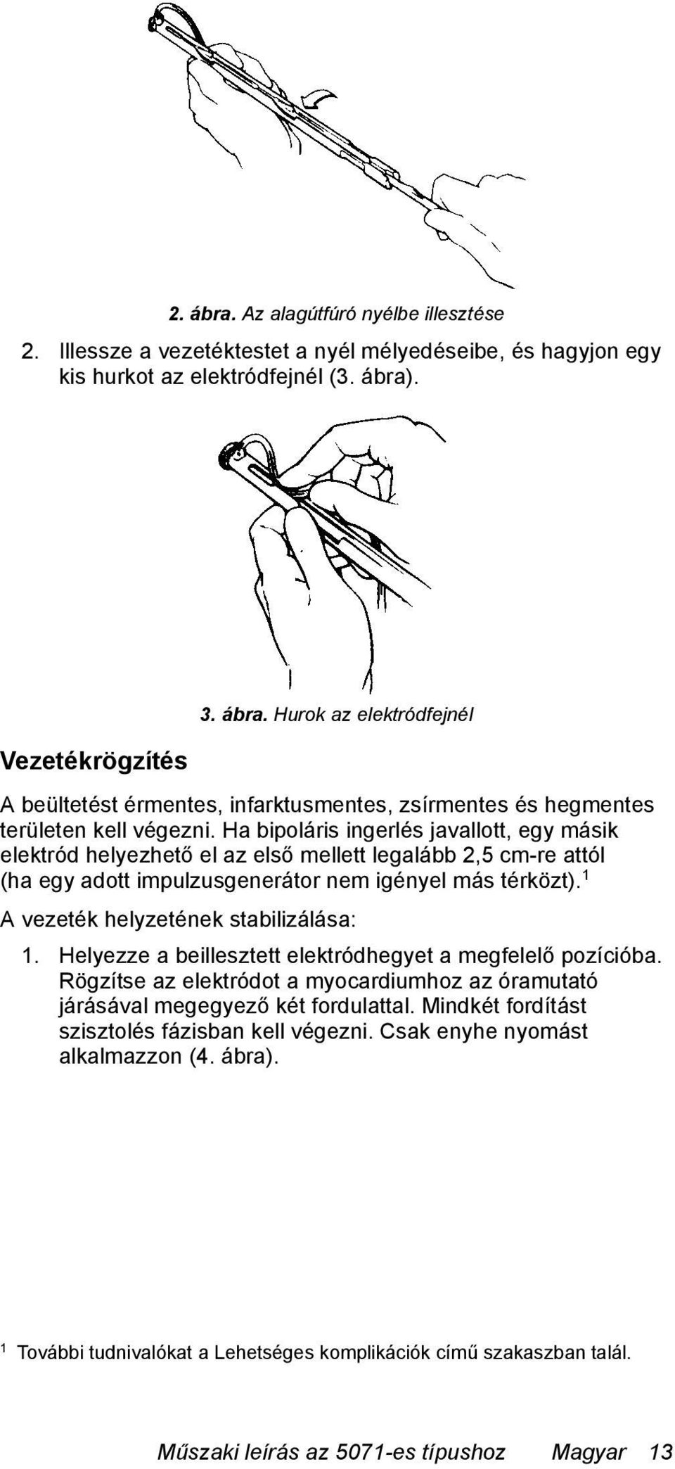 1 A vezeték helyzetének stabilizálása: 1. Helyezze a beillesztett elektródhegyet a megfelelő pozícióba. Rögzítse az elektródot a myocardiumhoz az óramutató járásával megegyező két fordulattal.