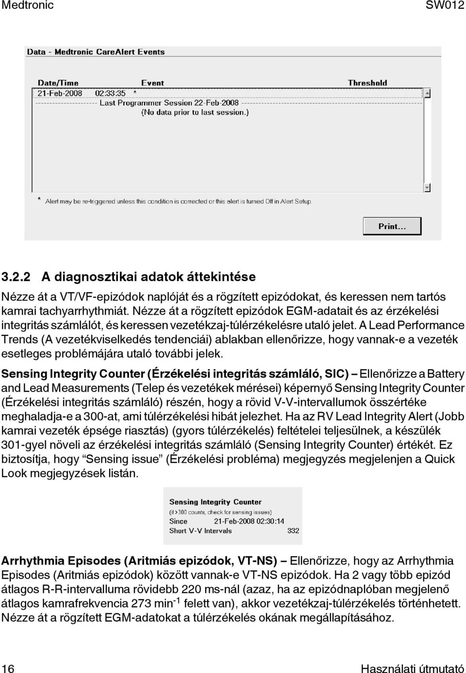 A Lead Performance Trends (A vezetékviselkedés tendenciái) ablakban ellenőrizze, hogy vannak-e a vezeték esetleges problémájára utaló további jelek.