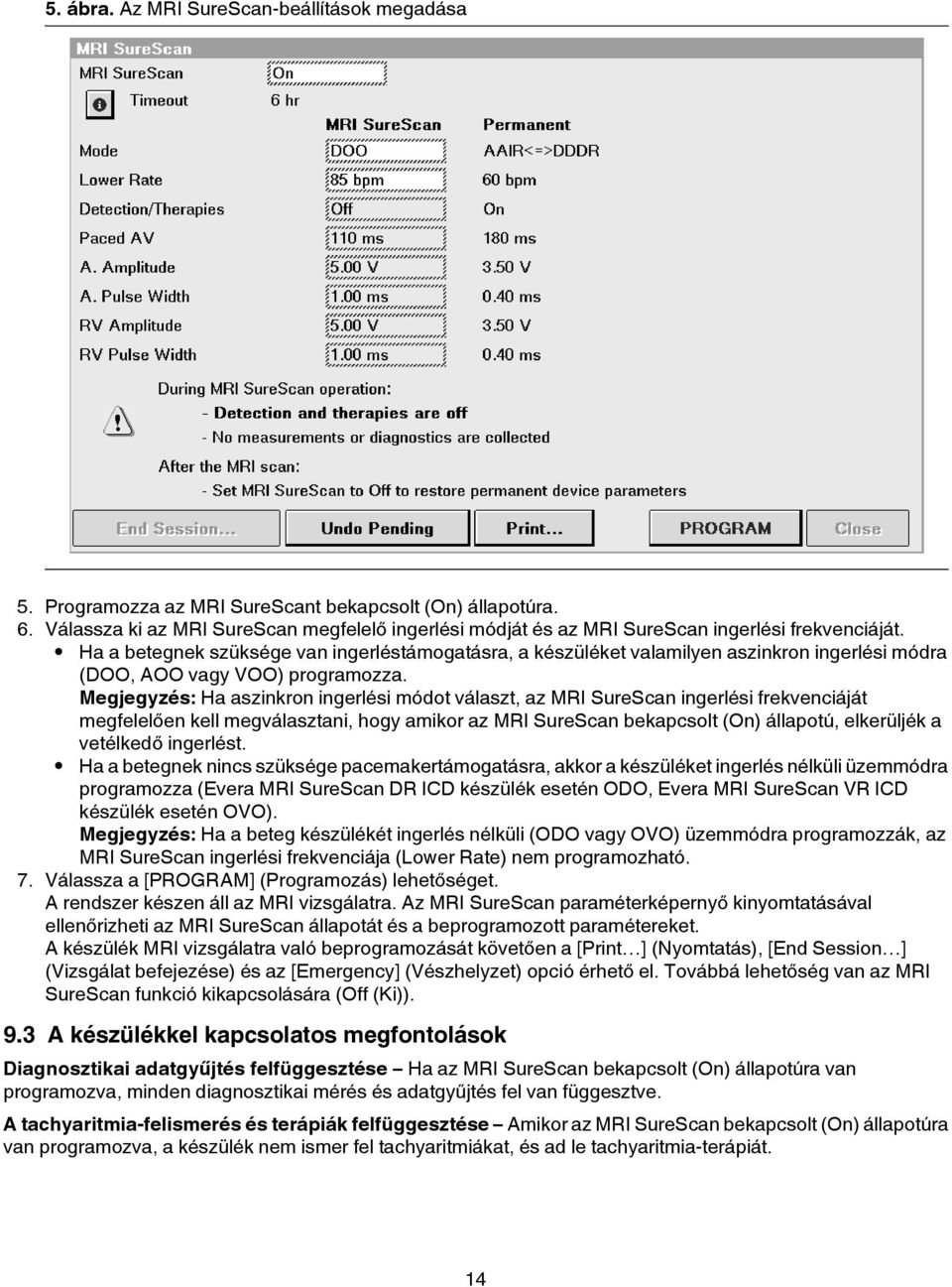 Ha a betegnek szüksége van ingerléstámogatásra, a készüléket valamilyen aszinkron ingerlési módra (DOO, AOO vagy VOO) programozza.