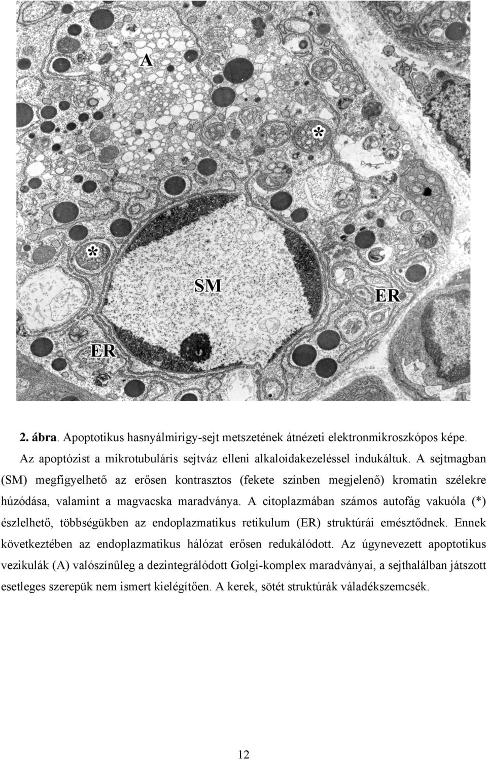 A citoplazmában számos autofág vakuóla (*) észlelhető, többségükben az endoplazmatikus retikulum (ER) struktúrái emésztődnek.