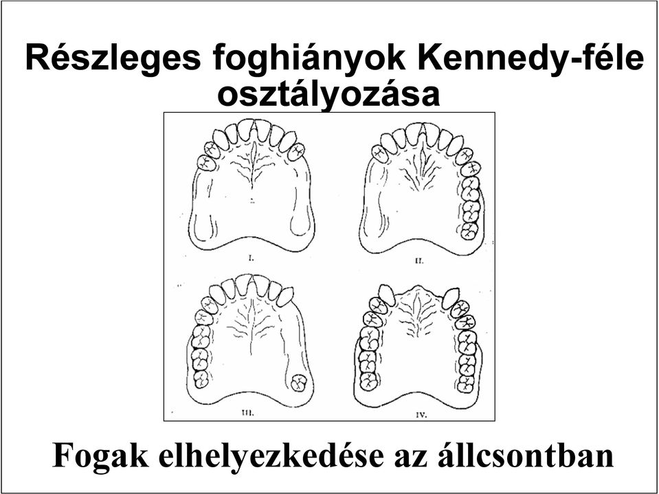 osztályozása Fogak