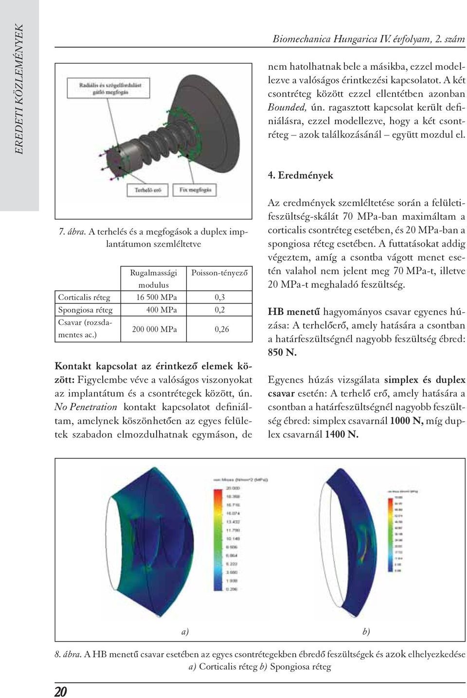 ábra. A terhelés és a megfogások a duplex implantátumon szemléltetve Rugalmassági Poisson-tényez modulus Corticalis réteg 16 500 MPa 0,3 Spongiosa réteg 400 MPa 0,2 Csavar (rozsdamentes ac.