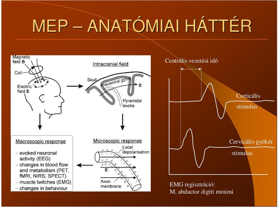 Cervicális gyökér stimulus EMG