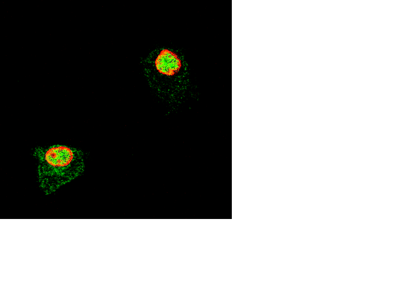 NF-κB magi transzlokációja LPS