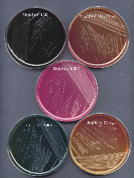 Tenyésztés: Szelektív-differenciáló táptalajokon: Eozinmetilénkék MacConkey ENDO SS=Salmonella/Shigella agar Biokémiai tulajdonságok: glukóz:+ laktóz: (kivéve a Shigella sonnei-t, ami késıi