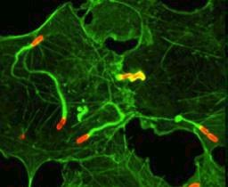 A Shigella intra- and inter-cellularis terjedése A baktérium egyik pólusán elhelyezkedı IcsA kötıdik és aktiválja az N-WASP (Wiscott-Aldrich syndrome protein) nevő fehérjét.