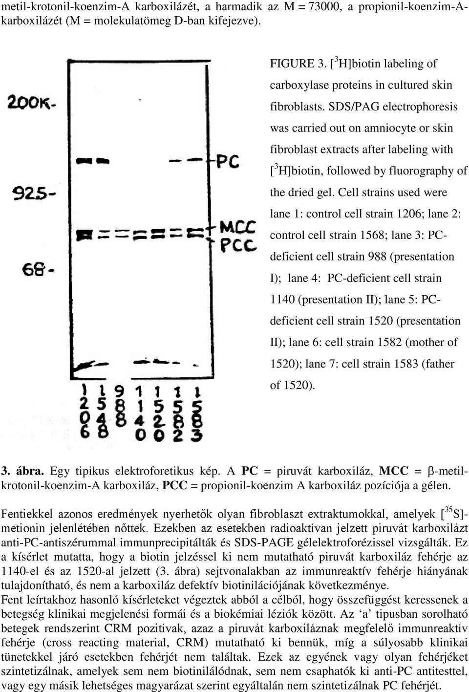 SDS/PAG electrophoresis was carried out on amniocyte or skin fibroblast extracts after labeling with [ 3 H]biotin, followed by fluorography of the dried gel.