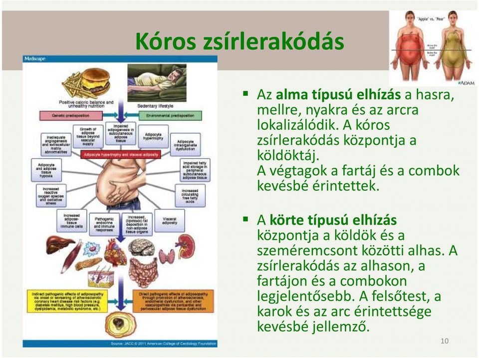 A körte típusú elhízás központja a köldök és a szeméremcsont közötti alhas.