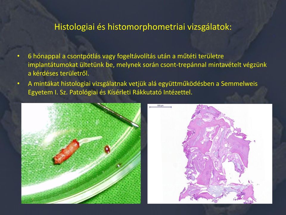 csont-trepánnal mintavételt végzünk a kérdéses területről.