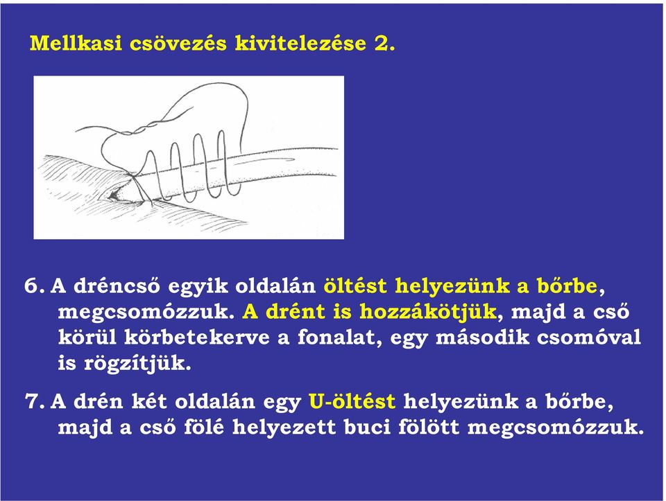 A drént is hozzákötjük, majd a cső körül körbetekerve a fonalat, egy második