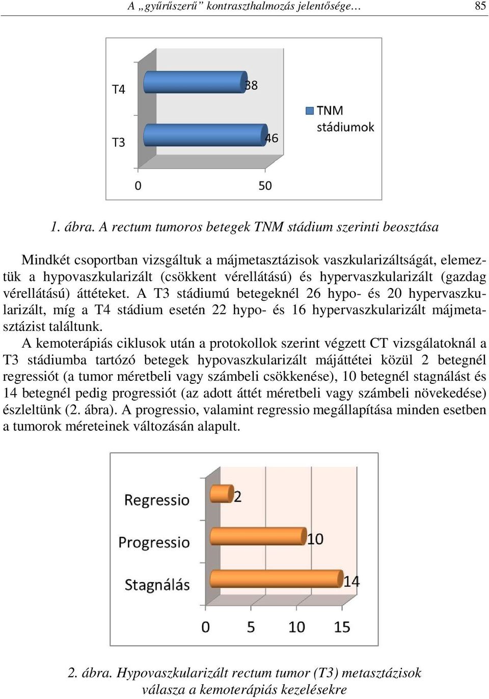 hypervaszkularizált (gazdag vérellátású) áttéteket. A T3 stádiumú betegeknél 26 hypo- és 20 hypervaszkularizált, míg a T4 stádium esetén 22 hypo- és 16 hypervaszkularizált májmetasztázist találtunk.