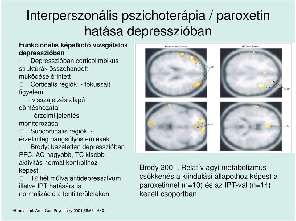 kezeletlen depresszióban PFC, AC nagyobb, TC kisebb aktivitás normál kontrollhoz képest 12 hét múlva antidepresszívum illetve IPT hatására is normalizáció a fenti területeken