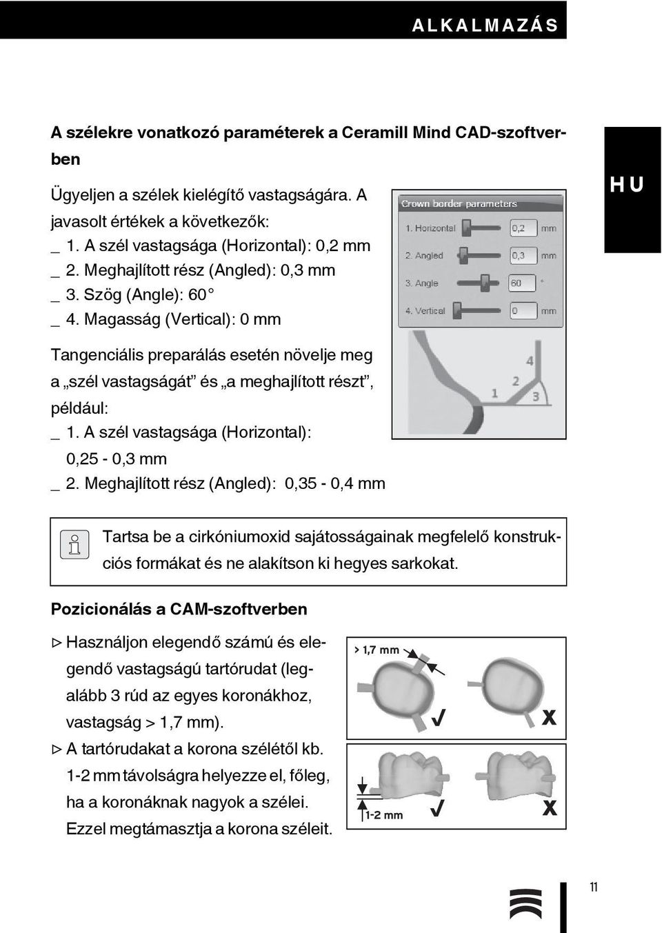 A szél vastagsága (Horizontal): 0,25-0,3 mm _ 2. Meghajlított rész (Angled): 0,35-0,4 mm Tartsa be a cirkóniumoxid sajátosságainak megfelelő konstrukciós formákat és ne alakítson ki hegyes sarkokat.