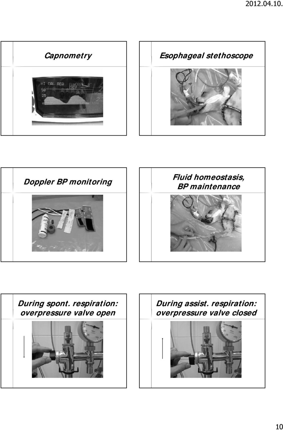 Fluid homeostasis, BP maintenance During spont.