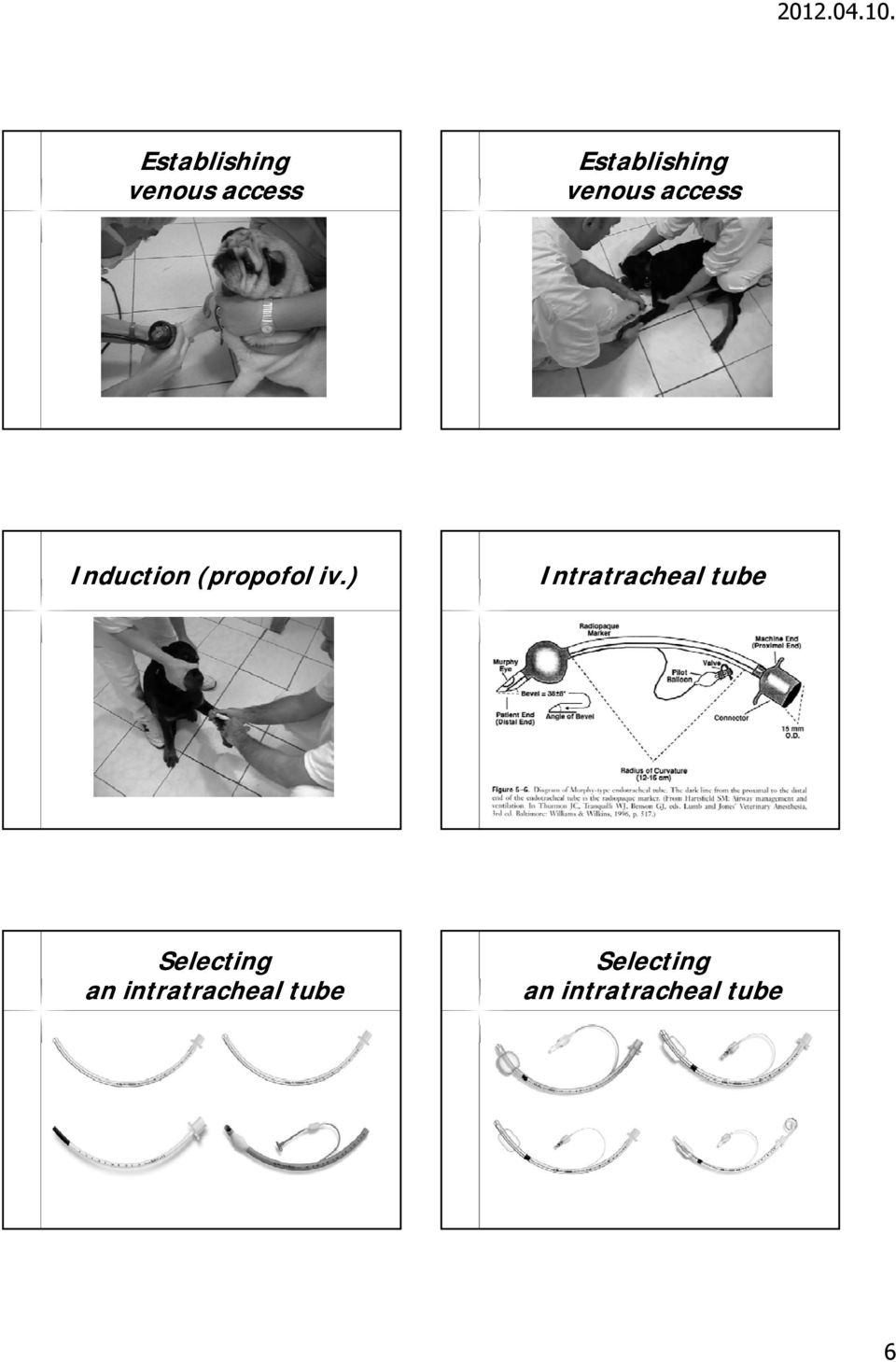 ) Intratracheal tube Selecting an