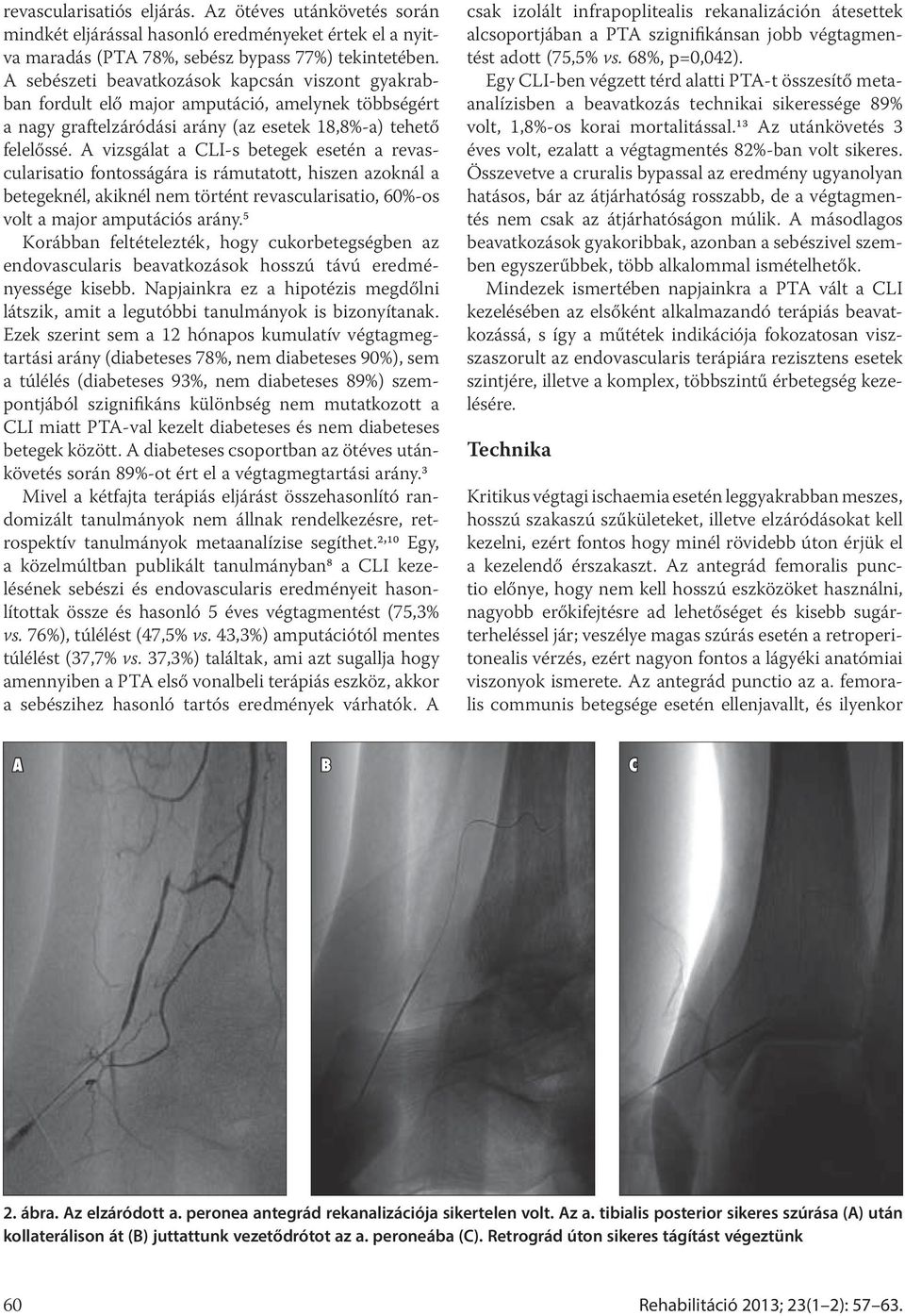 A vizsgálat a CLI-s betegek esetén a revascularisatio fontosságára is rámutatott, hiszen azoknál a betegeknél, akiknél nem történt revascularisatio, 60%-os volt a major amputációs arány.