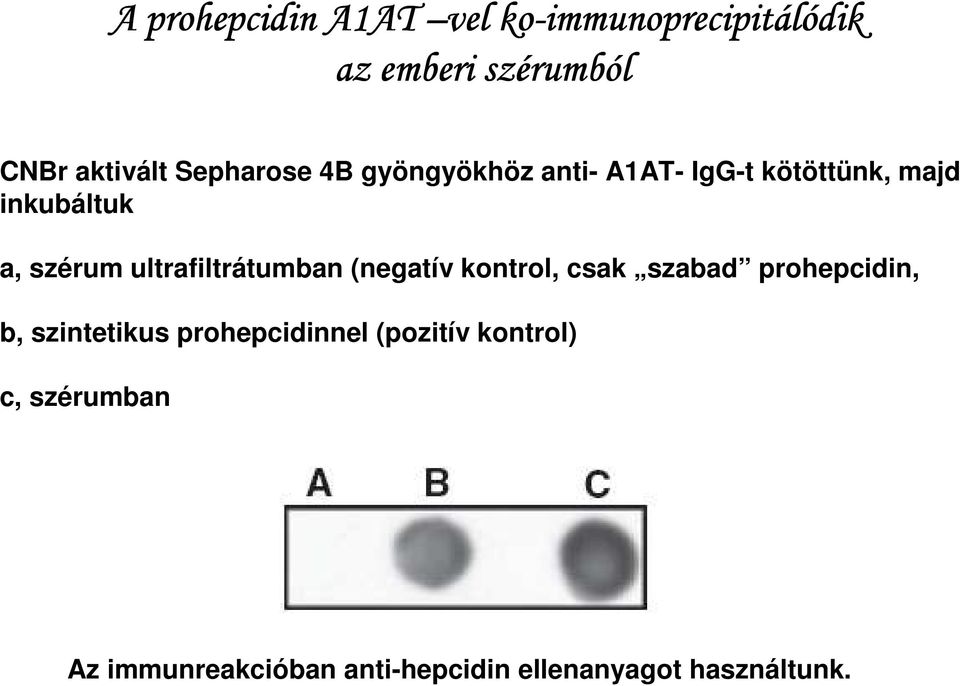 szérum ultrafiltrátumban (negatív kontrol, csak szabad prohepcidin, b, szintetikus