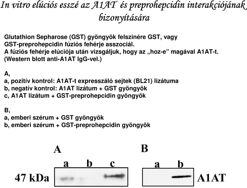 (Western blott anti-a1at IgG-vel.