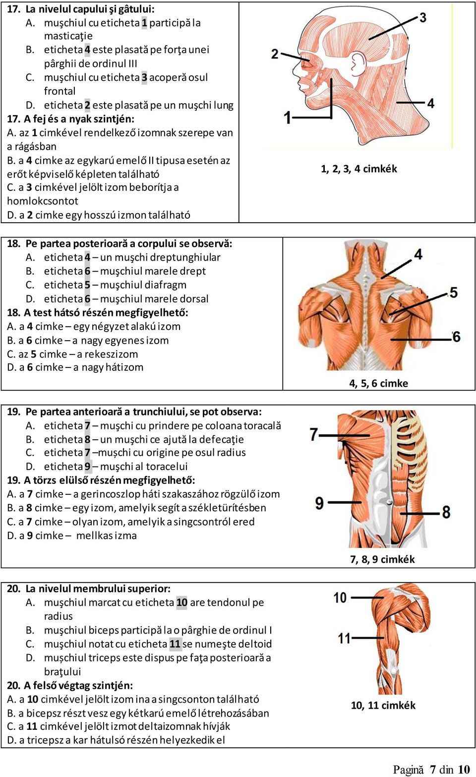 a 4 cimke az egykarú emelő II tipusa esetén az erőt képviselő képleten található C. a 3 cimkével jelölt izom beborítja a homlokcsontot D. a 2 cimke egy hosszú izmon található 18.