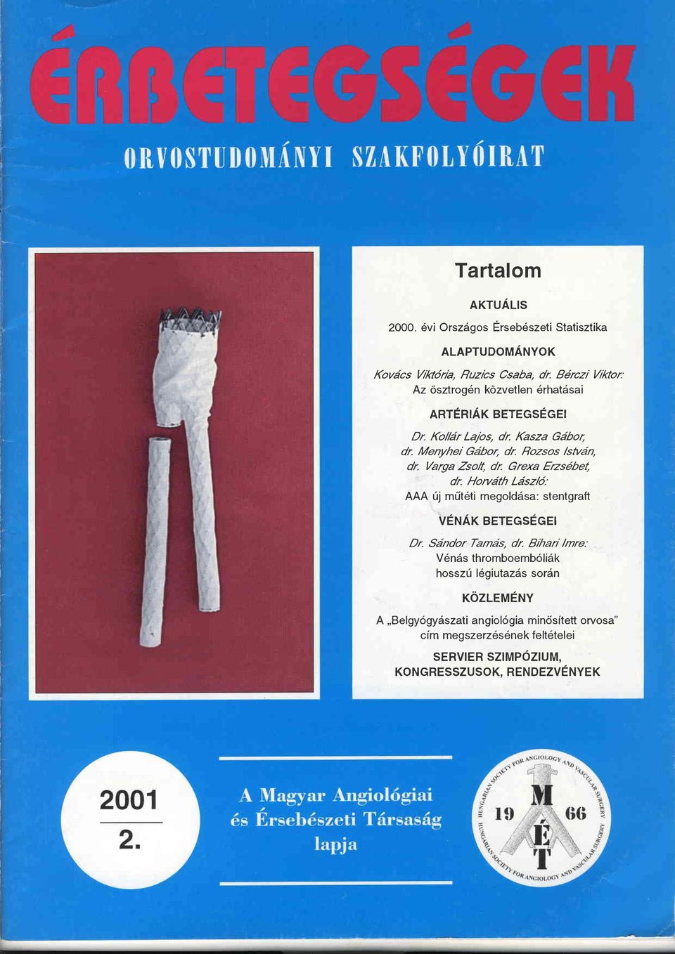 Varga Zsol{ dr Grexa Erzsdbel, dr. Horuäth Läsz/6: AAA üj müt6ti megoldäsa: stentgraft VENÄK BETEGSEGEI Dr. Sändor Tamäs, dr.