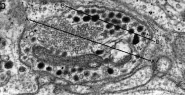 Non-szinaptikus transzmisszió és az autonóm neuromuszkuláris junkció szerkezete: AXON VARICOSITAS az effektor szerv közvetlen közelében a vegetatív axon terminális kiszélesedik; varicose