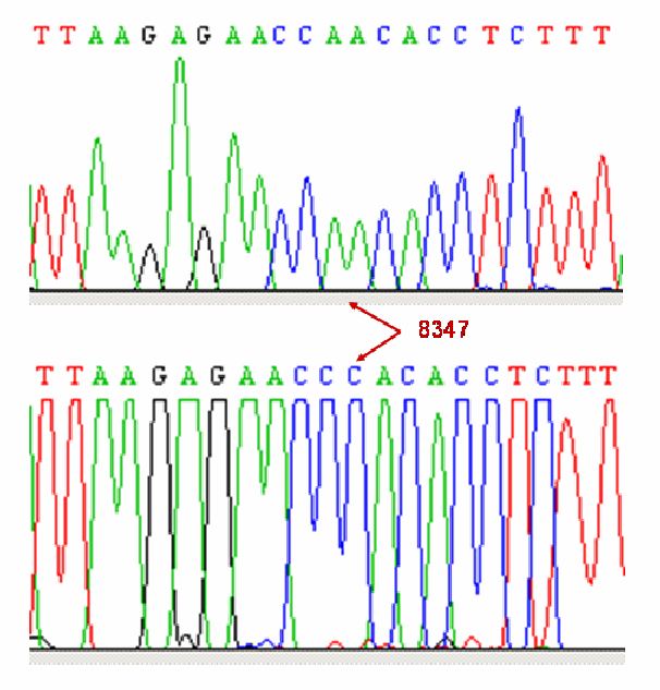 5.7. ábra: A: normális szekvencia, B: T8310G és T8311A heteroplazmikus nukleotid szubsztitúciók szekvencia analízise, C: a talált eltérések lokalizációja a trns Lys -ben 5.1.3. Az irodalomból ismert neurodegeneratív betegségekre hajlamosító szuszceptabilitási SNP 5.