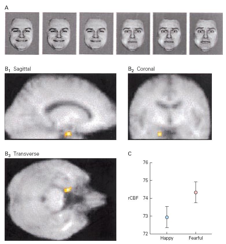 With the presentation of each of the faces only the left amygdala was found to vary in a systematic fashion.