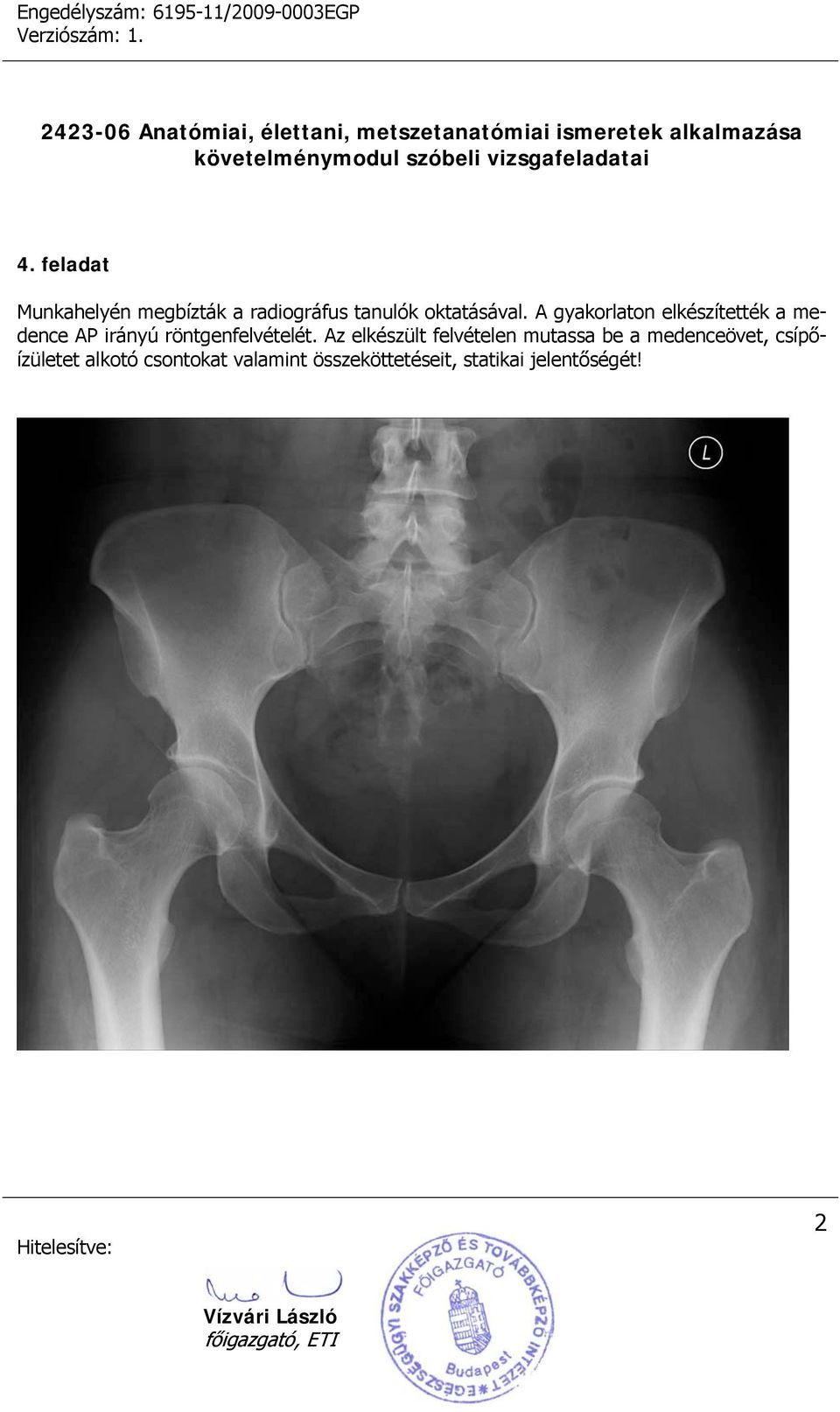 Az elkészült felvételen mutassa be a medenceövet, csípőízületet