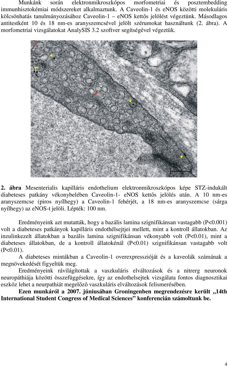 Másodlagos antitestként 10 és 18 nm-es aranyszemcsével jelölt szérumokat használtunk (2. ábra). A morfometriai vizsgálatokat AnalySIS 3.2 szoftver segítségével végeztük. 2.