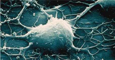 Sejt - kölcsönhatások az idegrendszerben dendrit Sejttest Axon sejtmag