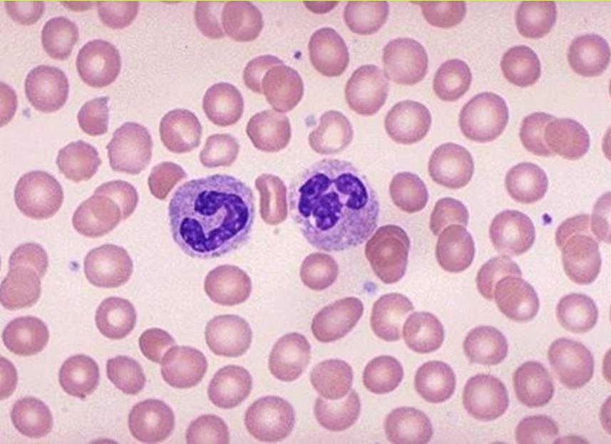 Perifériés vér kenet granulocyta thrombocyta