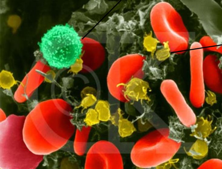 Perifériás vér kenet - másképp leukocyta