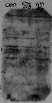 Western blot problémák megoldása Pöttyök a filmen (hiányzó csíkok): a légbuborékok miatt a transzfer nem volt kellően hatékony a film szennyezett volt az előhíváskor Túl sok csík a bloton: gyakran