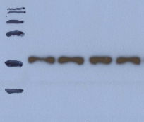 Western blot problémák megoldása Nincs vagy gyenge a jel: nem volt elég fehérje loadolva a gélre rossz vagy régi volt az 1. antitest a foszfoproteinek gyakran overnight inkubálást igényelnek az 1.