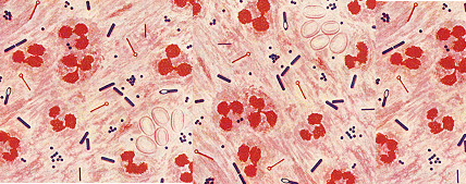 Taxonómia, klasszifikáció (Bergey's 2004) Kingdom: Bacteria; Phylum: Firmicutes; Class: