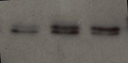 RELATIVE BAND INTENSITY EXPRESSZIÓ: FEHÉRJE Western blot 600 IZOELEKTROMOS FÓKUSZÁLÁS (simple