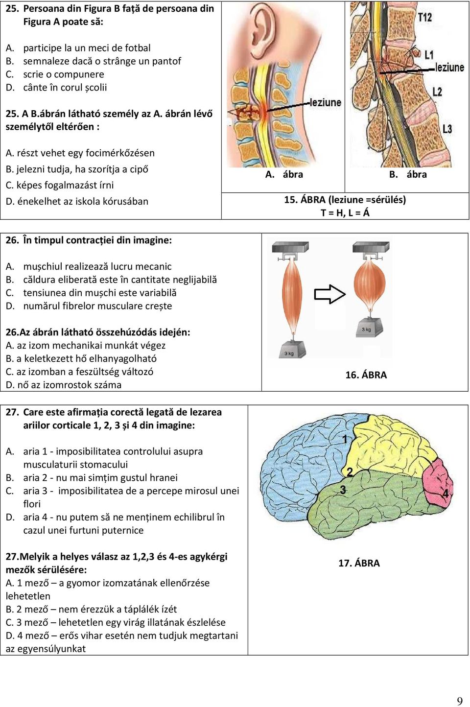 énekelhet az iskola kórusában 15. ÁBRA (leziune =sérülés) T = H, L = Á 26. În timpul contracției din imagine: A. mușchiul realizează lucru mecanic B. căldura eliberată este în cantitate neglijabilă C.