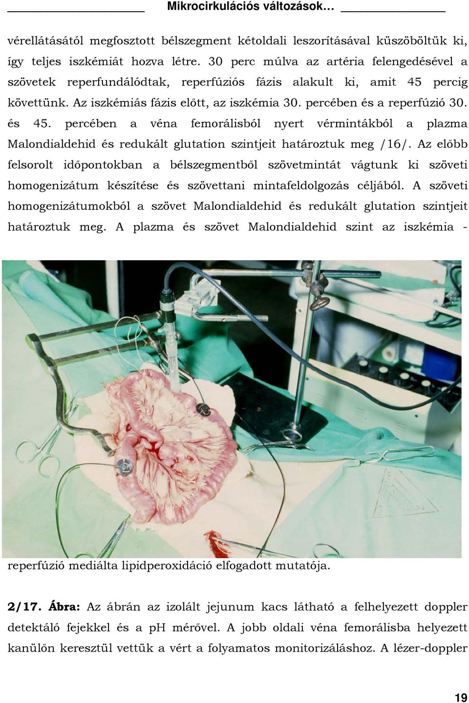 és 45. percében a véna femorálisból nyert vérmintákból a plazma Malondialdehid és redukált glutation szintjeit határoztuk meg /16/.