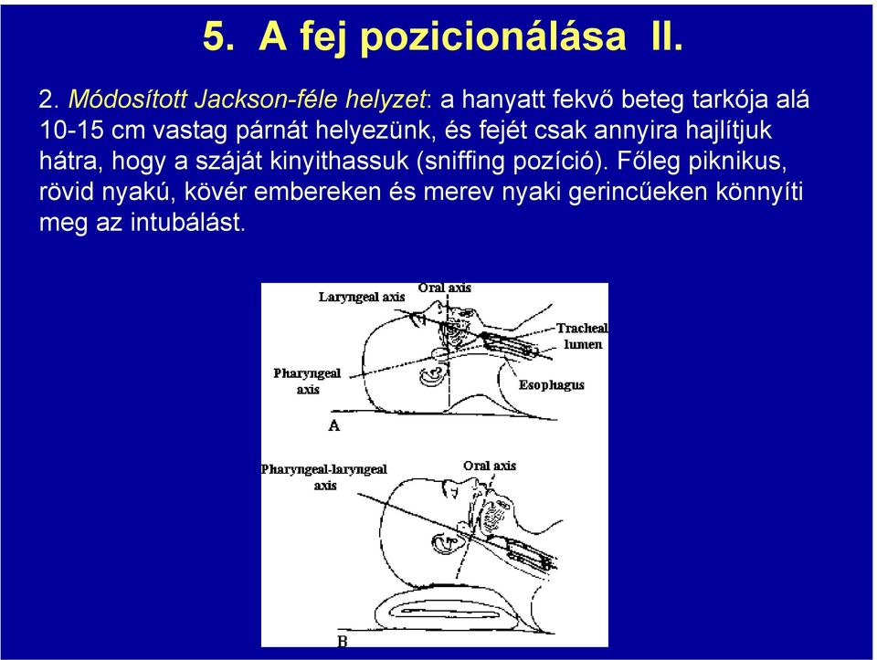 vastag párnát helyezünk, és fejét csak annyira hajlítjuk hátra, hogy a száját